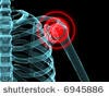 shoulder-inflammation
