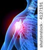 shoulder-pain